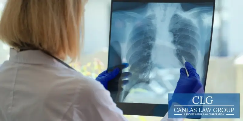 Mejor Abogado de Silicosis en Santa Ana Mejor Abogado de Silicosis en Santa Ana